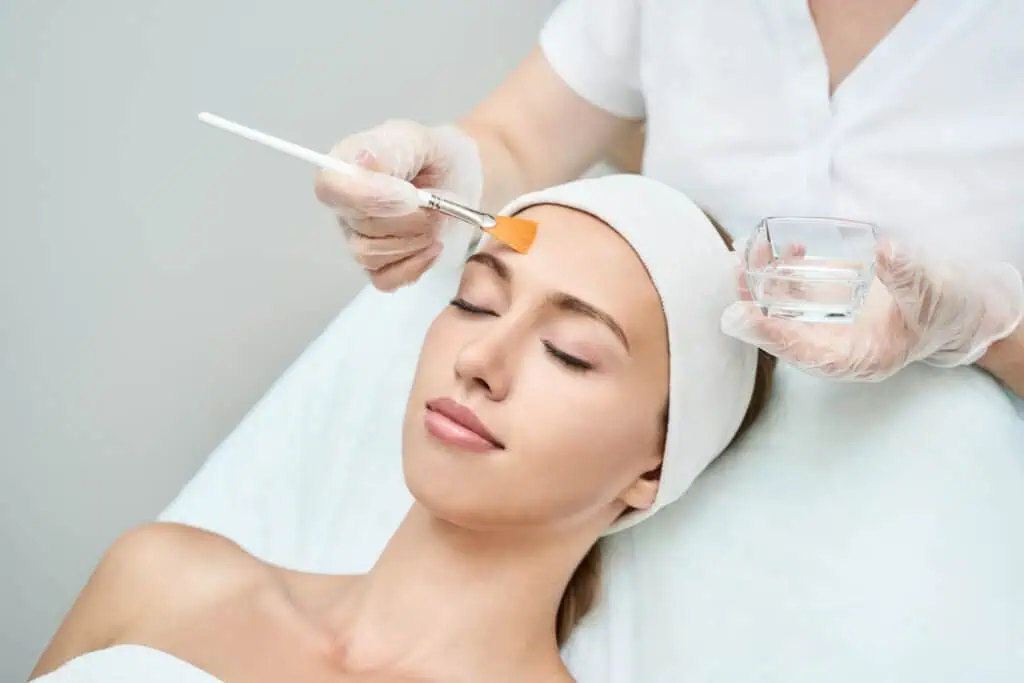 Chemical Peels Treatment at Haven Wellness & Aesthetics