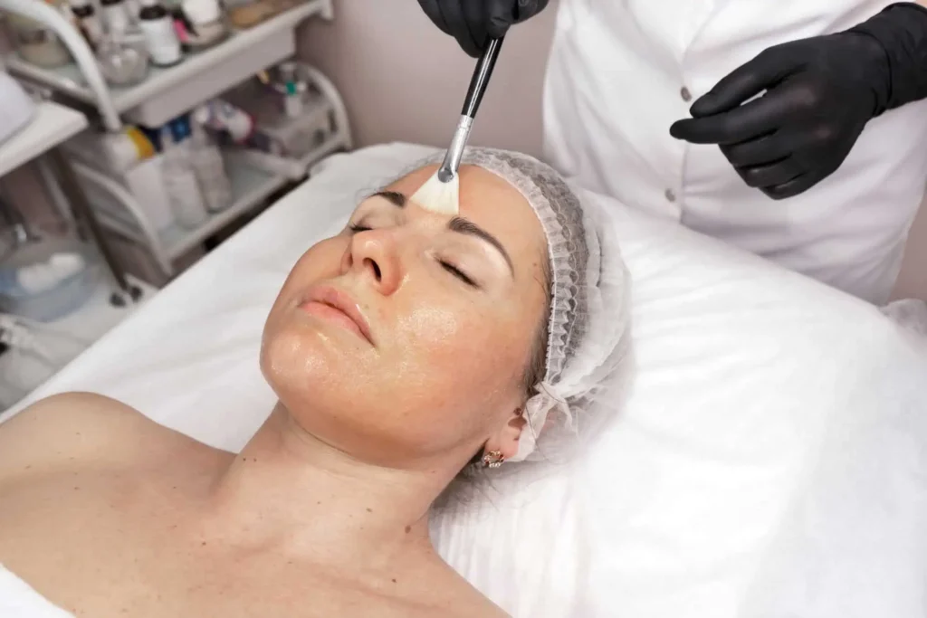 Chemical Peels in Southern Pines, NC at Haven Skin Wellness
